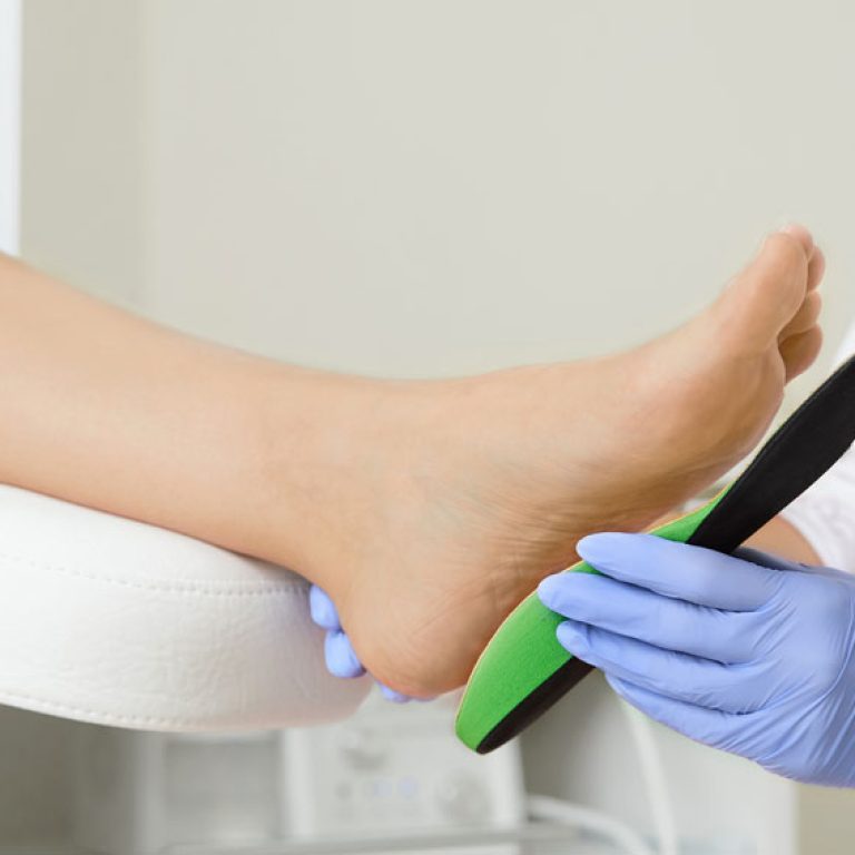 custom-orthotics-north-vancouver